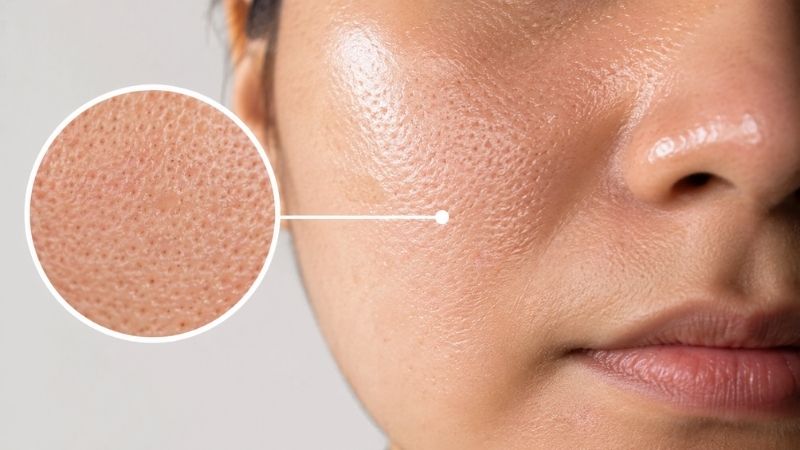 face wash for oily skin and large pores